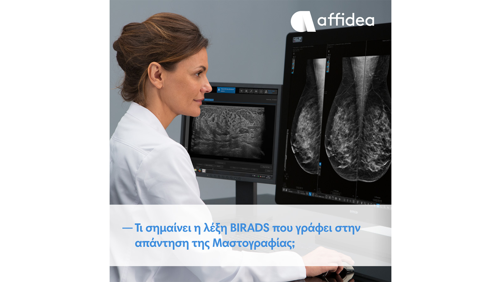 Affidea: Τι σημαίνει η ταξινόμηση BIRADS στη μαστογραφία και γιατί είναι σημαντική